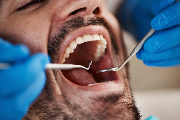 Best Emergency Dental Services for Seniors in Garnet, CA